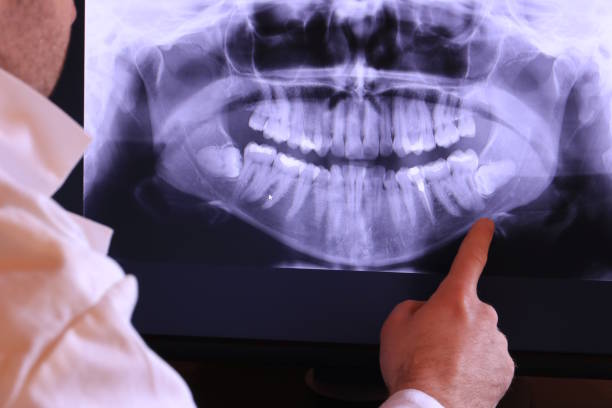 Best After-Hours Dental Trauma Care in Annandale, NJ