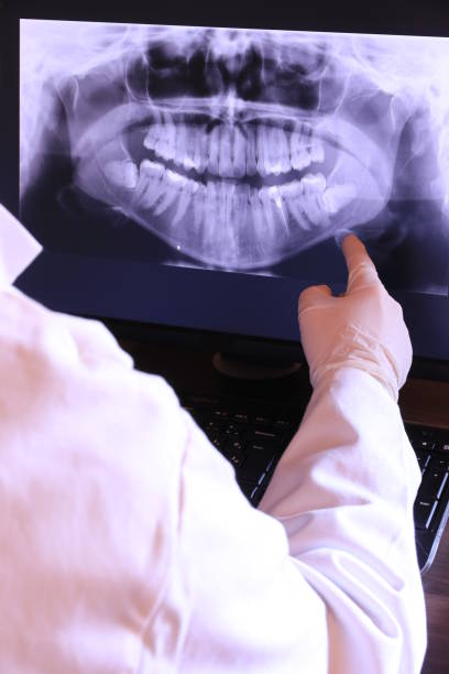 Best Emergency Dental Care for Broken or Chipped Teeth in Annandale, NJ