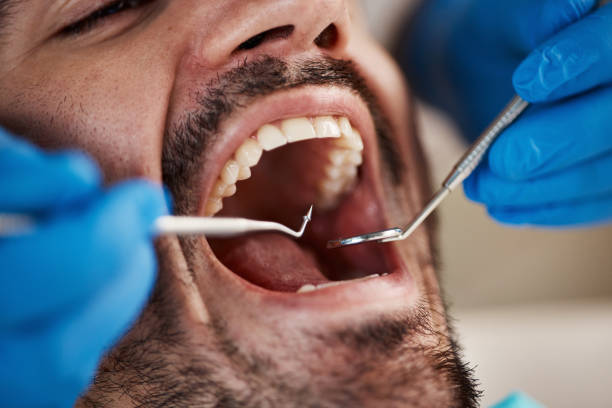 Best Emergency Orthodontic Services in Annandale, NJ