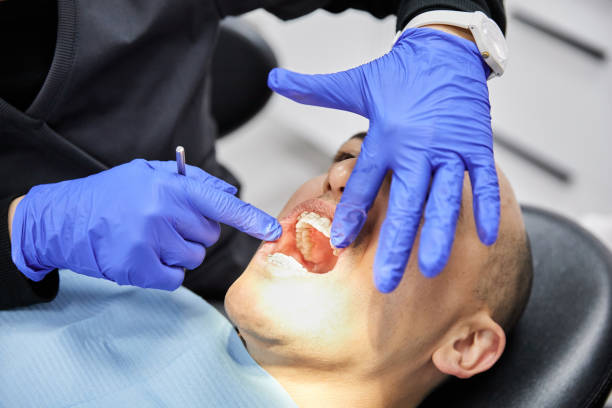 Best Emergency Gum Treatment in Annandale, NJ